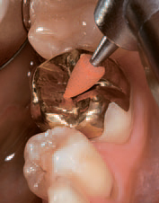 Применение EpsiPol P0033